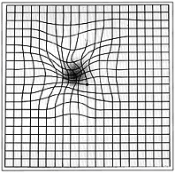 Amsler grid with distortion